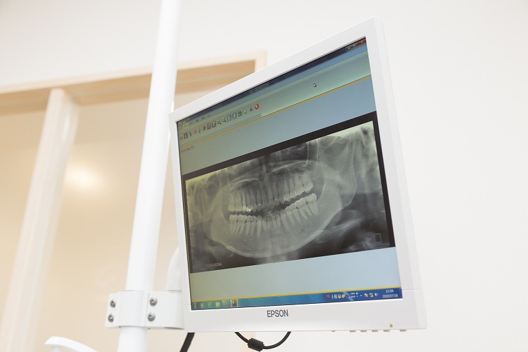 歯科用デジタルレントゲン