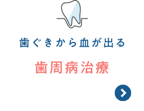 歯ぐきから血が出る 歯周病治療